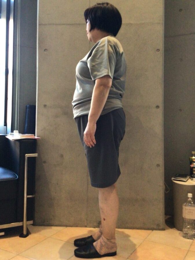 体側面ビフォー