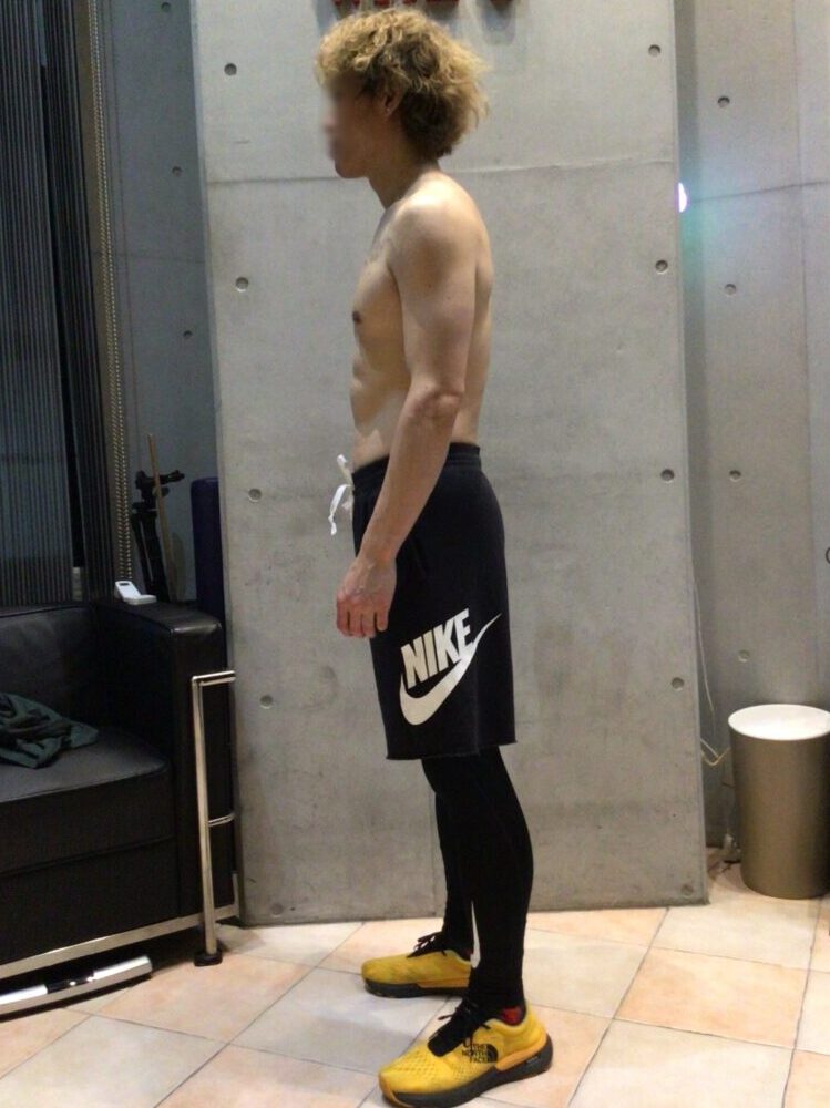 体側面ビフォー